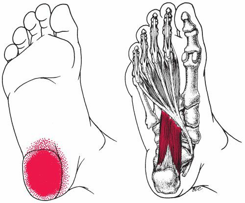 Intrinsieke Voetspieren - Afbeelding 6