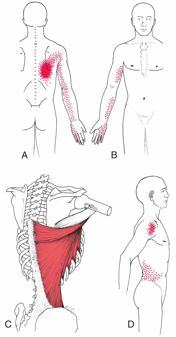 Latissimus Dorsi - Afbeelding 2