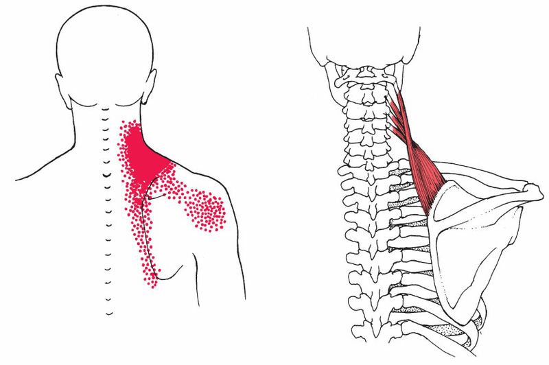 Levator Scapulae - Afbeelding 2