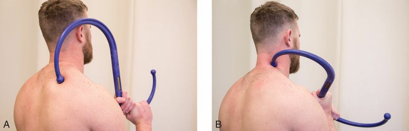 Levator Scapulae - Afbeelding 4