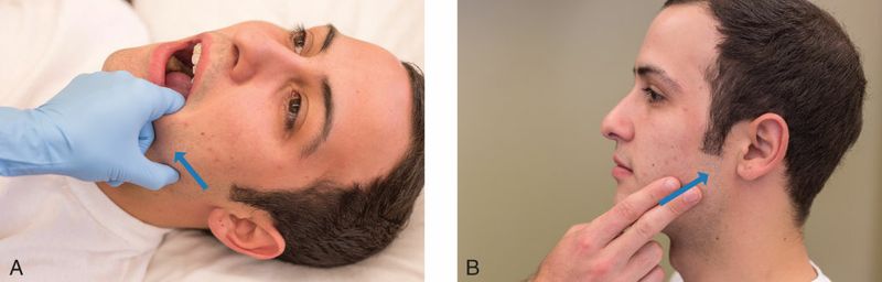 Masseter - Afbeelding 4