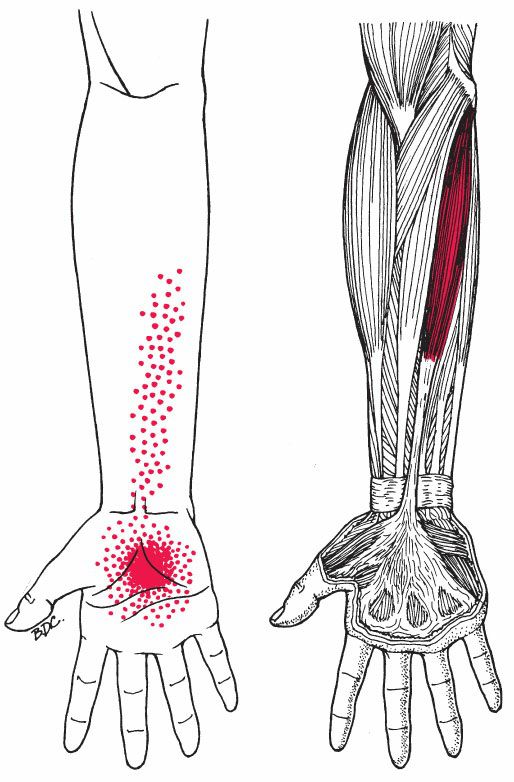 Palmaris Longus - Afbeelding 2