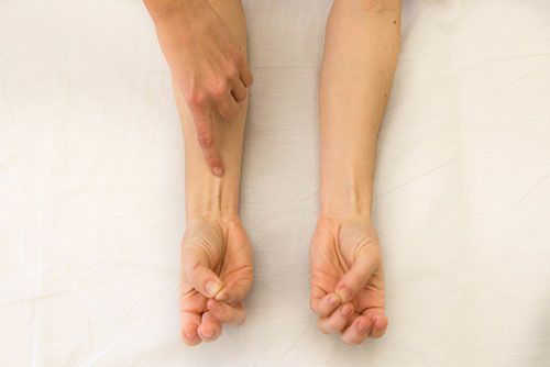 Palmaris Longus - Afbeelding 3