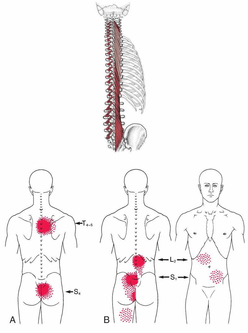 Paraspinale Spieren - Afbeelding 4