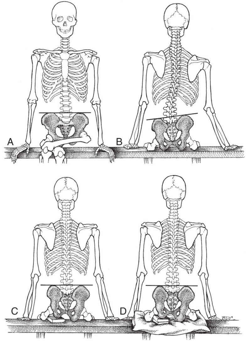 Paraspinale Spieren - Afbeelding 5