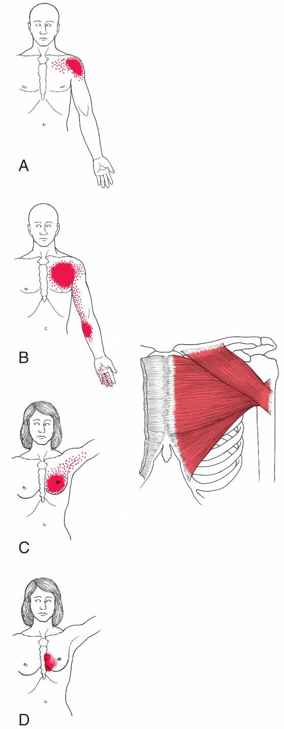 Pectoralis Major - Afbeelding 3