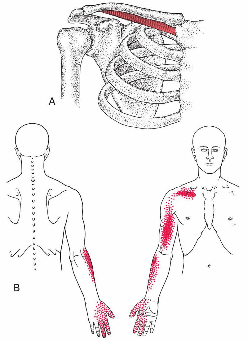 Pectoralis Major - Afbeelding 5
