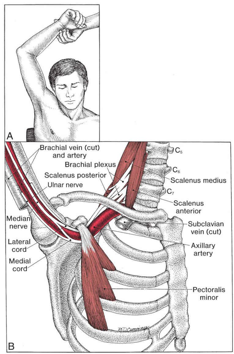 Pectoralis Minor - Afbeelding 2