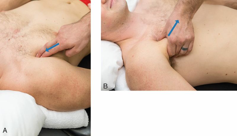 Pectoralis Minor - Afbeelding 4