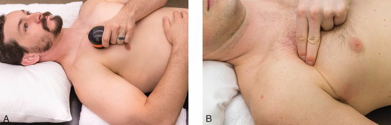 Pectoralis Minor - Afbeelding 5