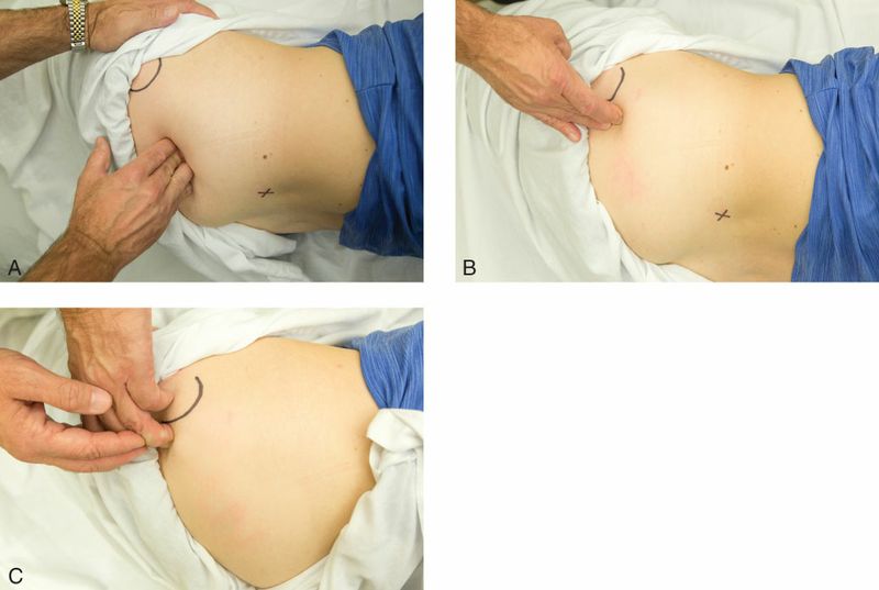 Piriformis - Afbeelding 7