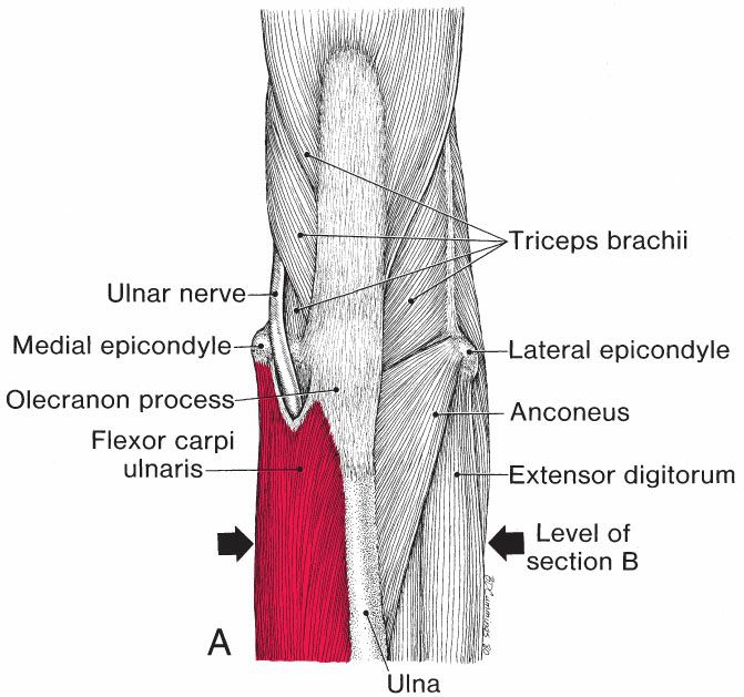 Polsflexoren - Afbeelding 7