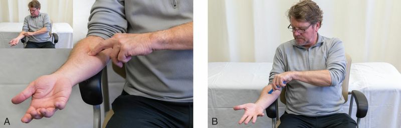 Polsflexoren - Afbeelding 9