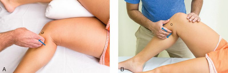 Popliteus - Afbeelding 5