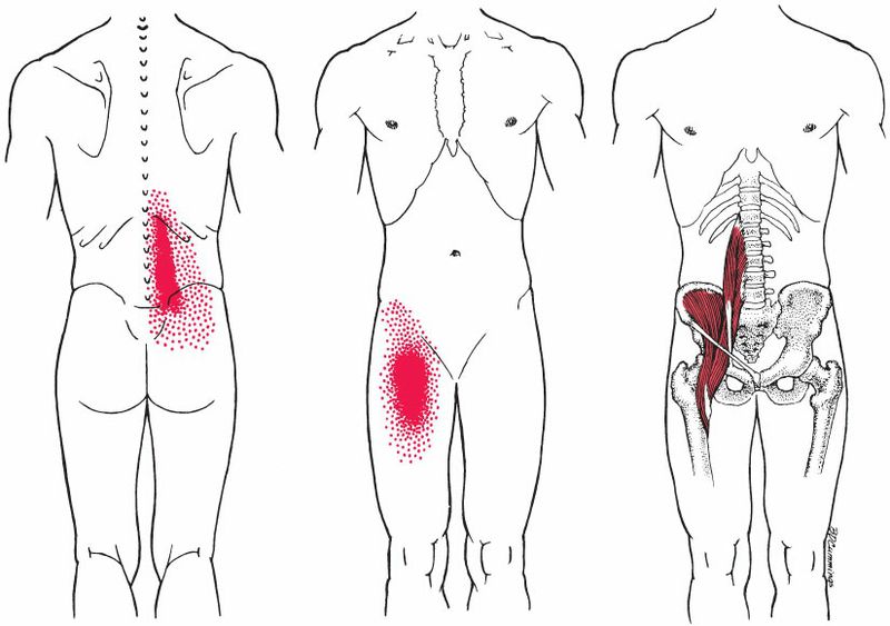 Psoas Major - Afbeelding 2