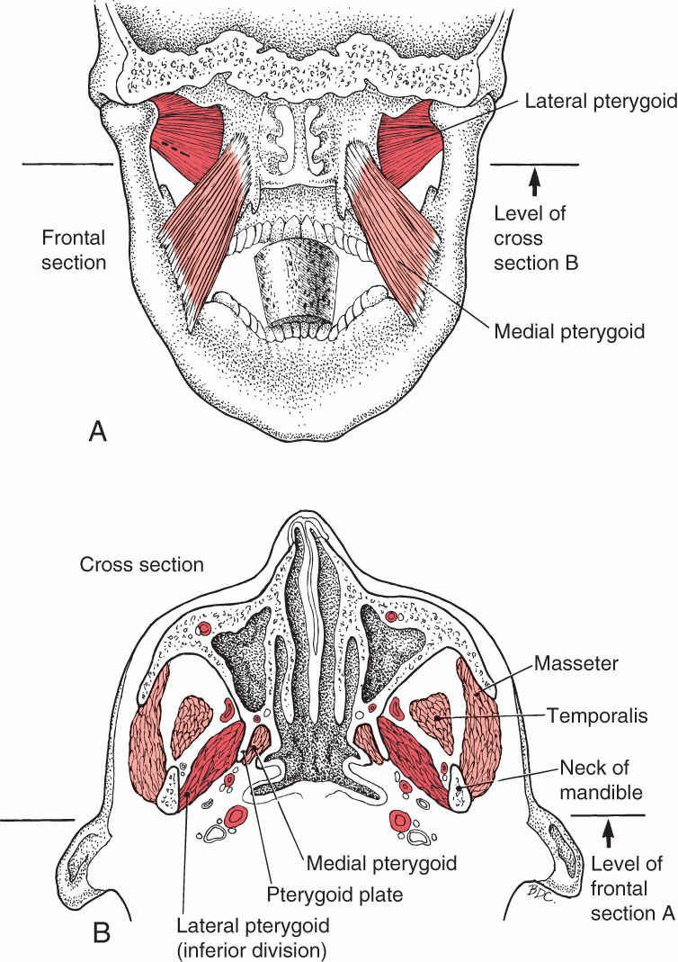 Pterygoideus Lateralis - Afbeelding 2