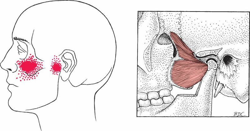 Pterygoideus Lateralis - Afbeelding 3