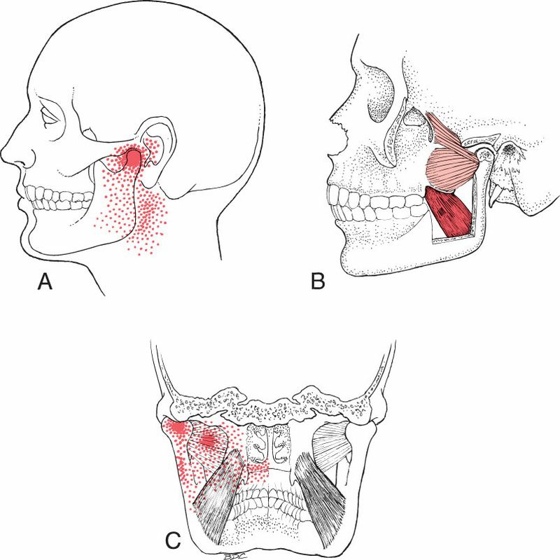 Pterygoideus Medialis - Afbeelding 2