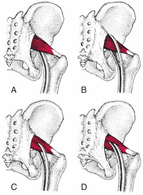 Quadratus Femoris - Afbeelding 4