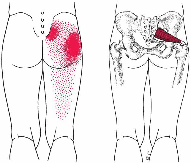 Quadratus Femoris - Afbeelding 5