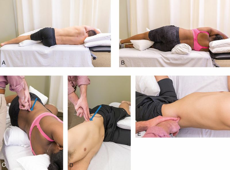 Quadratus Lumborum - Afbeelding 10