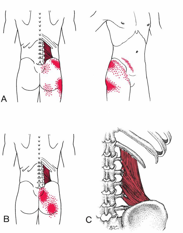 Quadratus Lumborum - Afbeelding 6