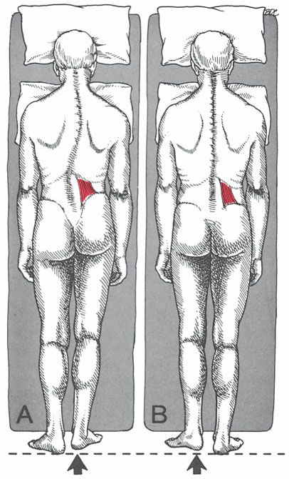 Quadratus Lumborum - Afbeelding 7