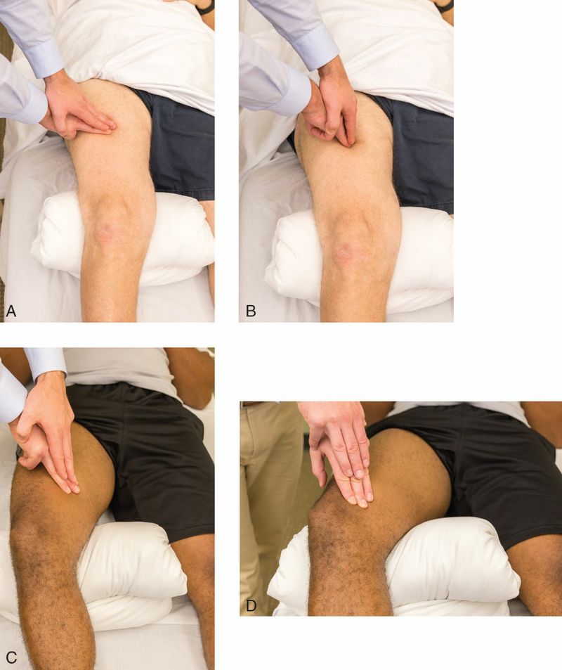 Quadriceps - Afbeelding 10