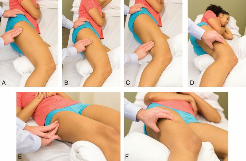 Quadriceps - Afbeelding 11