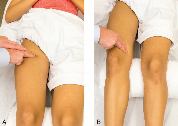 Quadriceps - Afbeelding 12