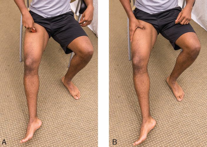 Quadriceps - Afbeelding 15