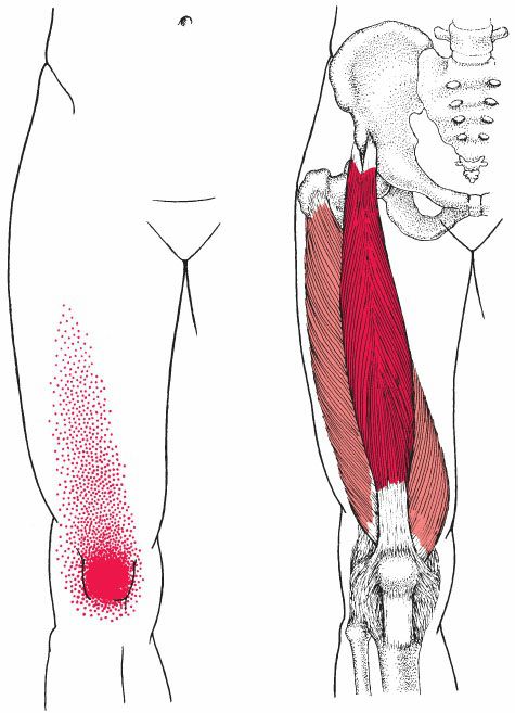 Quadriceps - Afbeelding 5