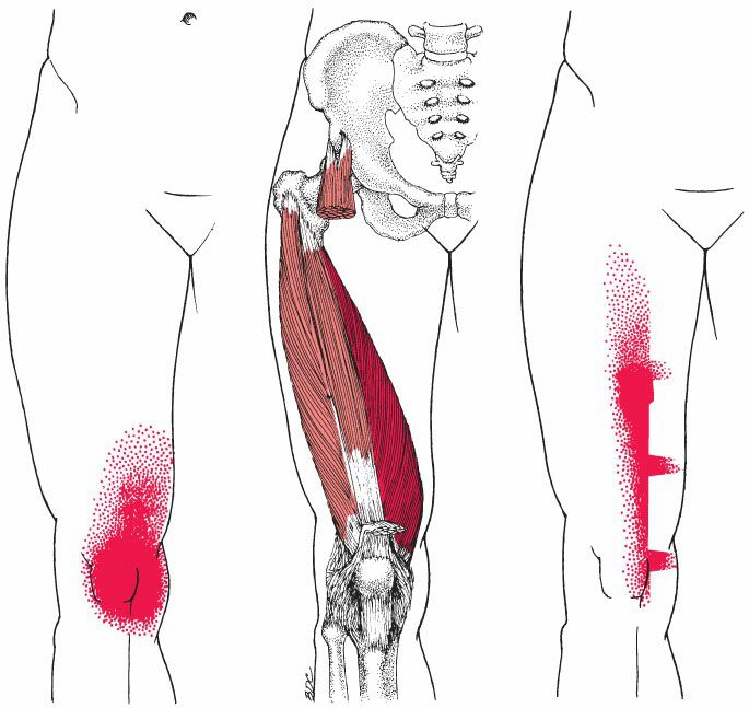 Quadriceps - Afbeelding 7