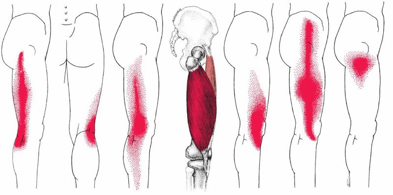 Quadriceps - Afbeelding 8