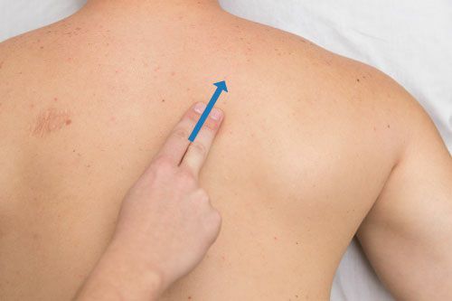 Rhomboidei - Afbeelding 3