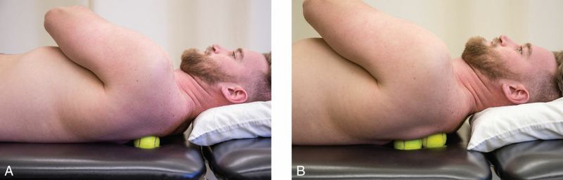 Rhomboidei - Afbeelding 5