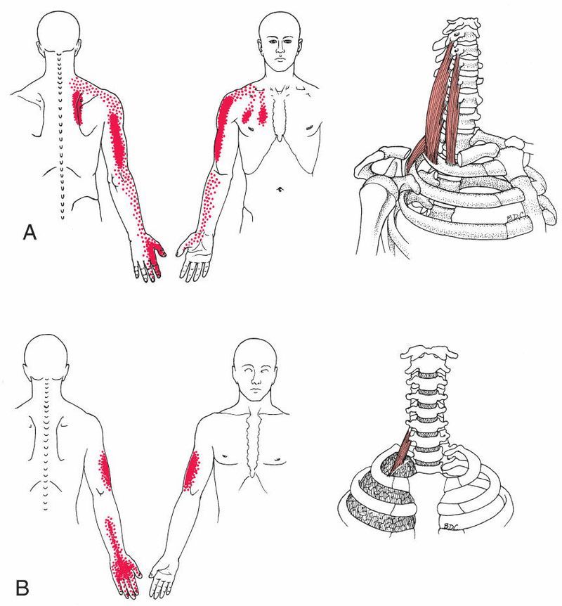 Scaleni - Afbeelding 3