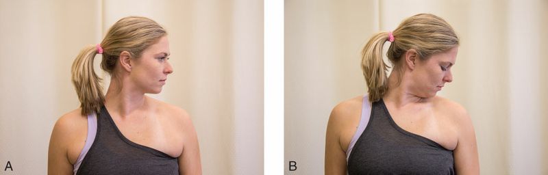 Scaleni - Afbeelding 4