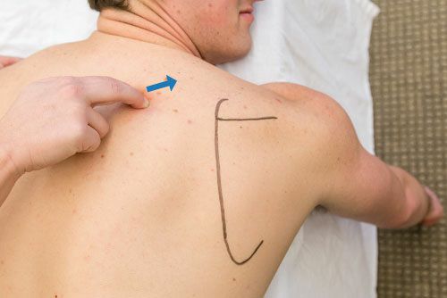 Serratus Posterior - Afbeelding 6