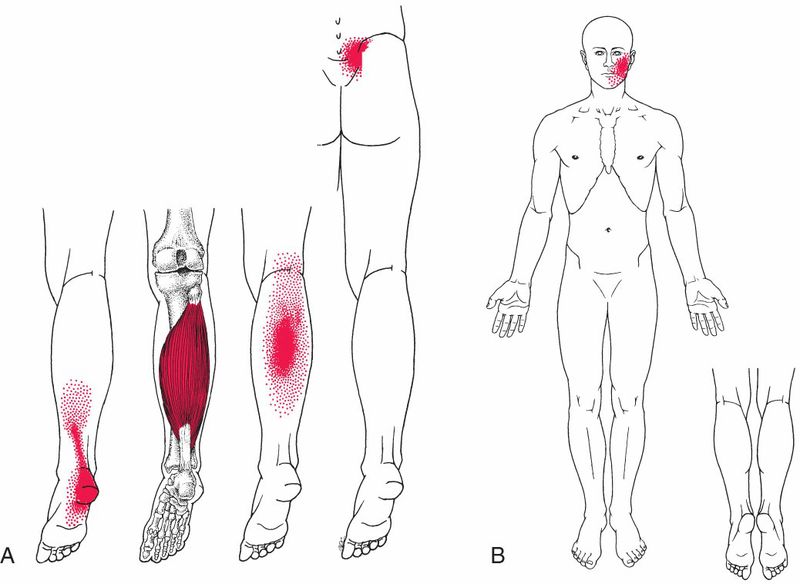 Soleus - Afbeelding 5