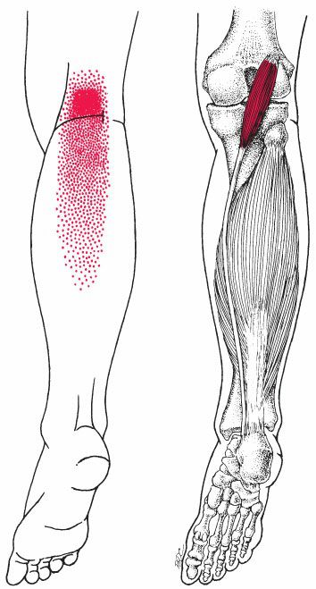 Soleus - Afbeelding 6