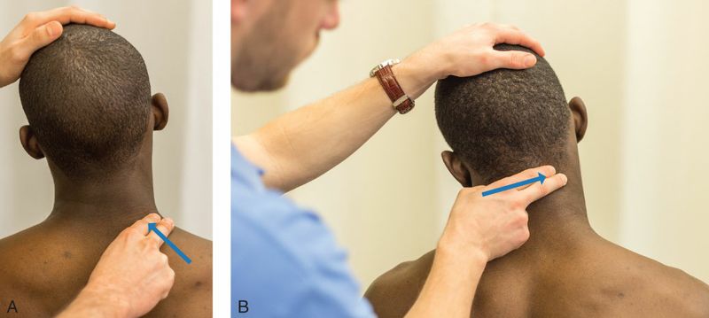 Splenius Capitis - Afbeelding 3