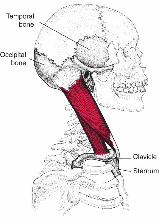 Sternocleidomastoideus - Afbeelding 1