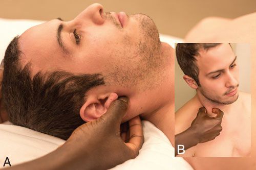 Sternocleidomastoideus - Afbeelding 3