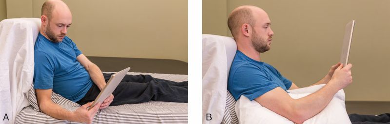 Sternocleidomastoideus - Afbeelding 4