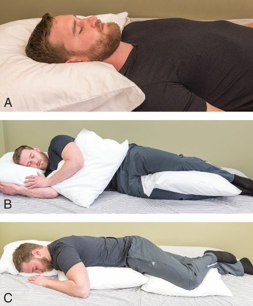 Sternocleidomastoideus - Afbeelding 5