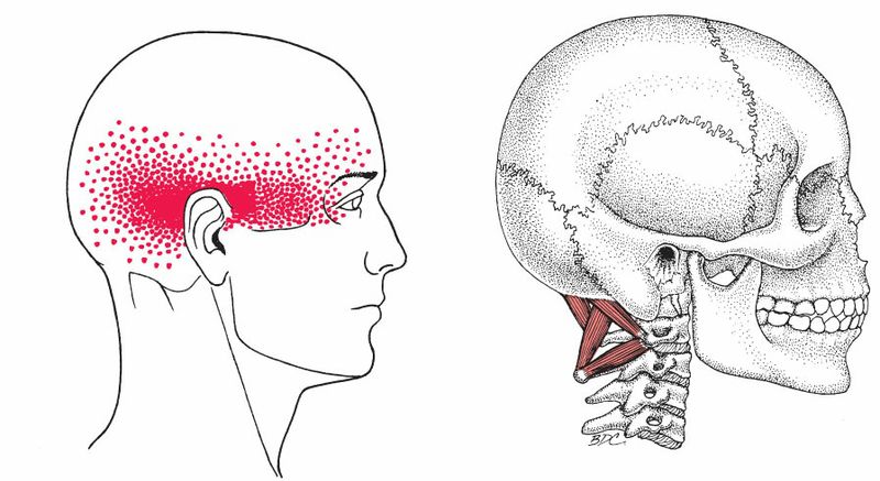 Suboccipitale Spieren - Afbeelding 3