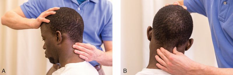 Suboccipitale Spieren - Afbeelding 4