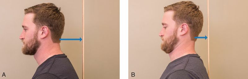 Suboccipitale Spieren - Afbeelding 6