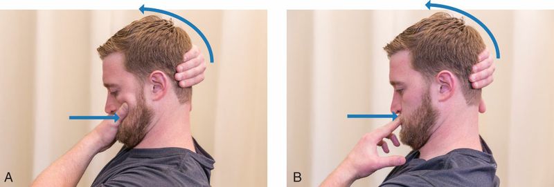 Suboccipitale Spieren - Afbeelding 7